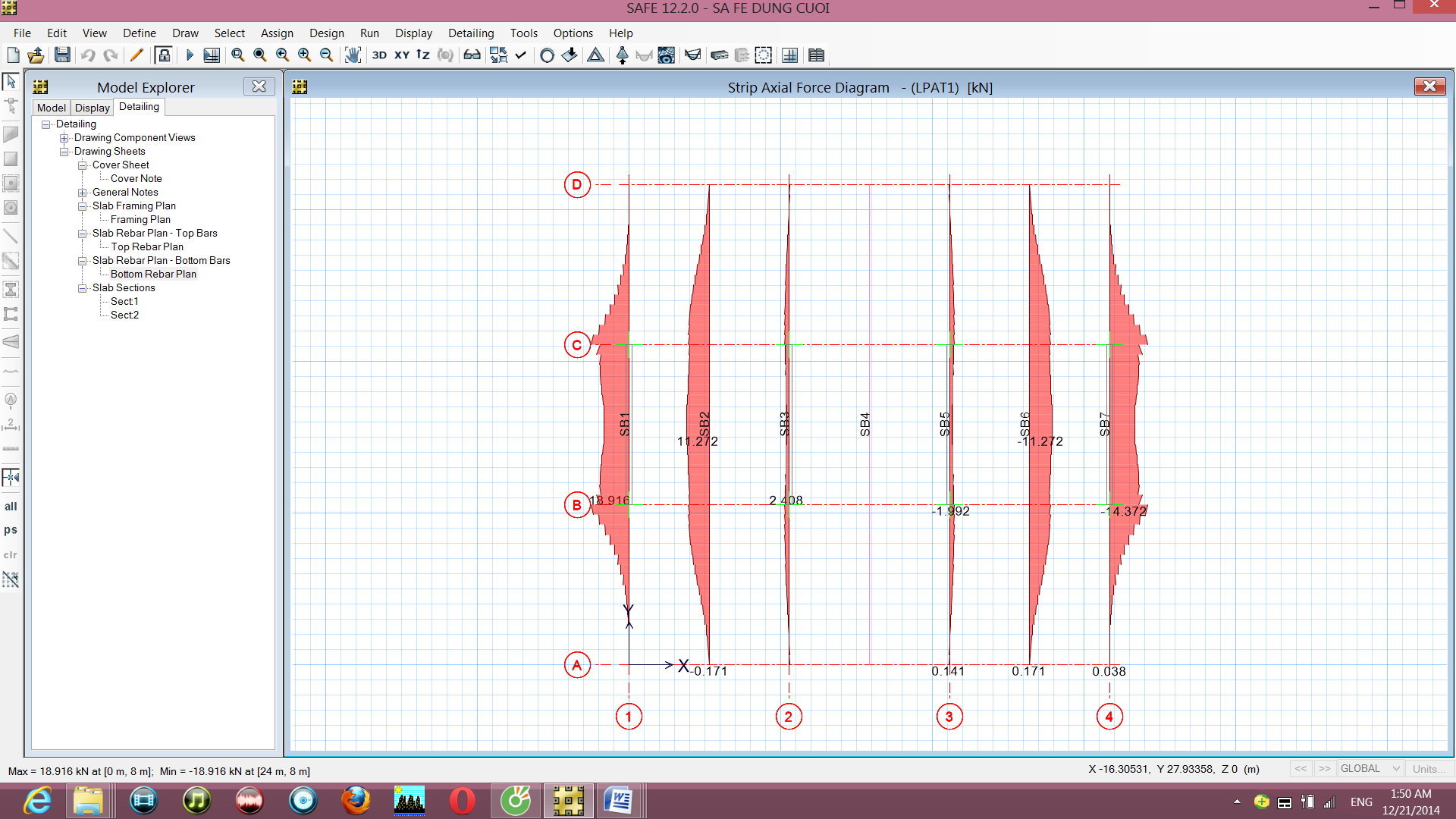C:\Users\SONY\Desktop\ngang y tren m dai\11.bmp