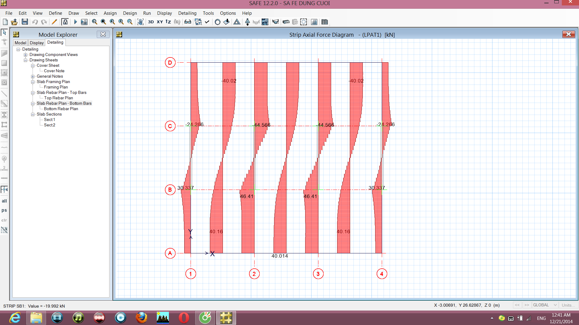 C:\Users\SONY\Desktop\ngang y tren m dai\SA FE DUNG CUOI.bmp