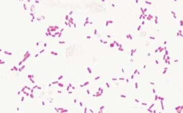 Nghiên cứu tác động của cao chiết lá vối (Cleistocalyx opercculatus) lên một số vi khuẩn gây nhiễm trùng thường gặp